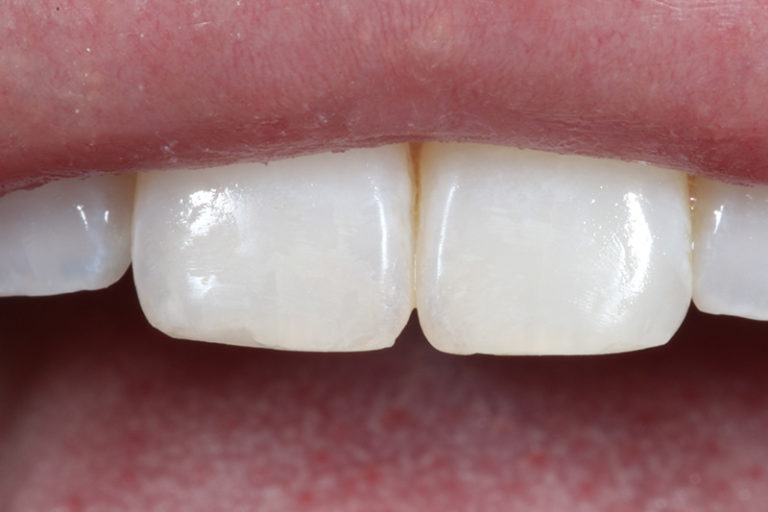 Photos Aesthetic & Implant Dental Arts